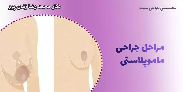مراحل جراحی ماموپلاستی 