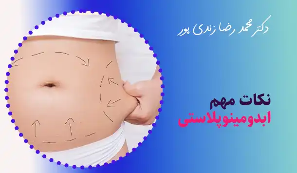 نکات مهم ابدومینوپلاستی