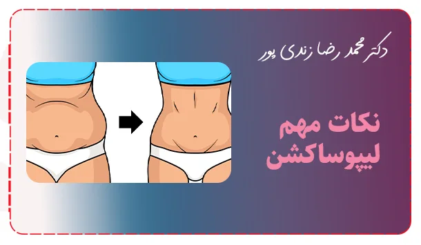 نکات مهم لیپوساکشن