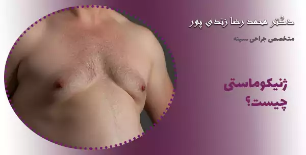 ژنیکوماستی چیست؟