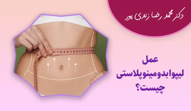 عمل لیپوابدومینوپلاستی چیست؟