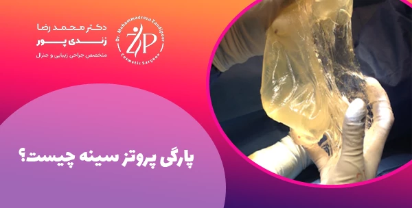 پارگی پروتز سینه چیست؟