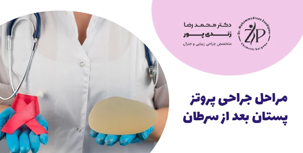 مراحل جراحی پروتز پستان بعد از سرطان 