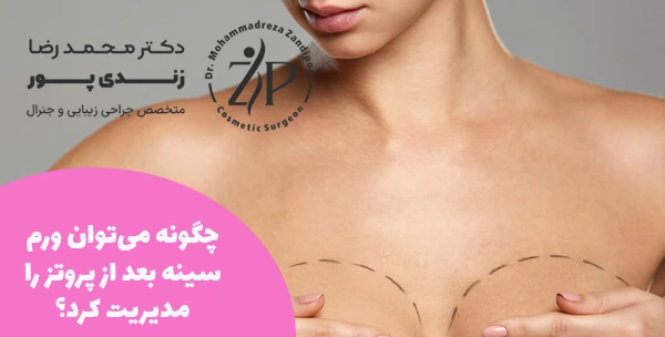 چگونه می‌توان ورم سینه بعد از پروتز را مدیریت کرد؟