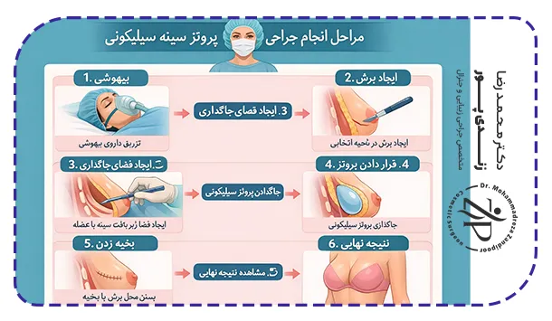 مراحل انجام جراحی پروتز سینه سیلیکونی