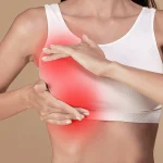انقباض کپسولی پروتز سینه