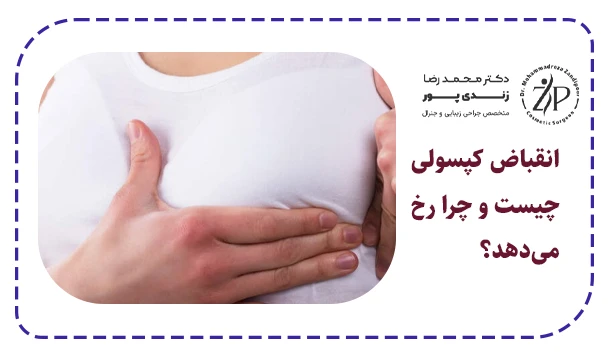 انقباض کپسولی چیست و چرا رخ می‌دهد؟