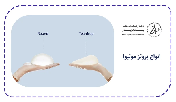 انواع پروتز موتیوا