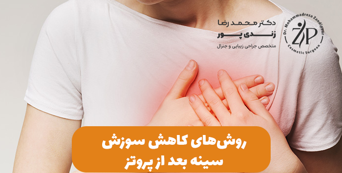 روش‌های کاهش سوزش سینه بعد از پروتز