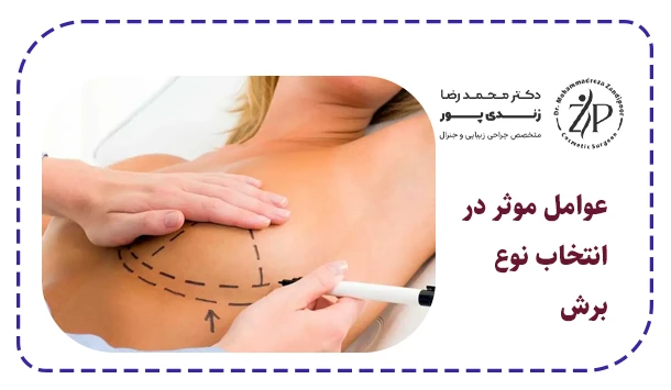 عوامل موثر در انتخاب نوع برش