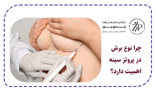 چرا نوع برش در پروتز سینه اهمیت دارد؟