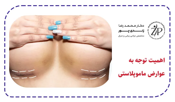 اهمیت توجه به عوارض ماموپلاستی