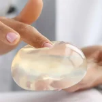 پروتز سینه منتور