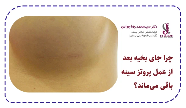 چرا جای بخیه بعد از عمل پروتز سینه باقی می‌ماند؟