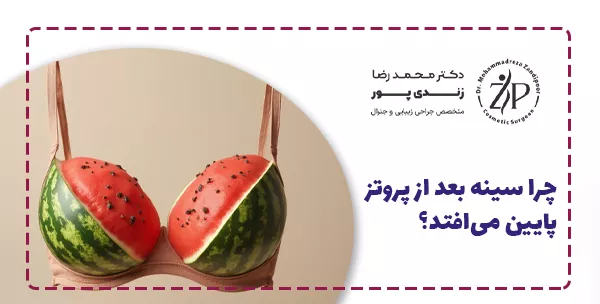 چرا سینه بعد از پروتز پایین می‌افتد؟