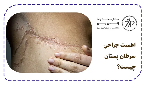 اهمیت جراحی سرطان پستان چیست؟