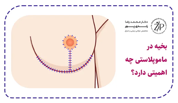 بخیه در ماموپلاستی چه اهمیتی دارد؟