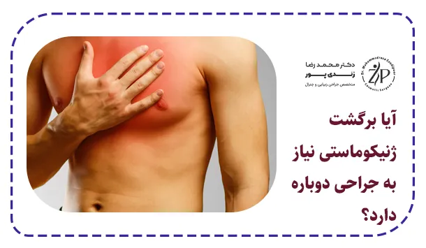 آیا برگشت ژنیکوماستی نیاز به جراحی دوباره دارد؟