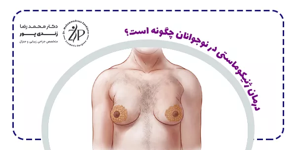 درمان ژنیکوماستی در نوجوانان چگونه است؟