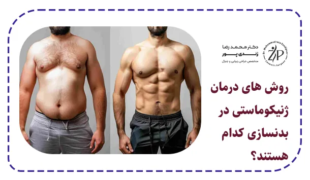 روش های درمان ژنیکوماستی در بدنسازی کدام هستند؟