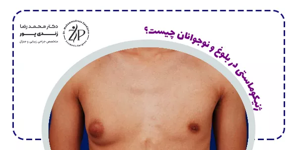 ژنیکوماستی در بلوغ و نوجوانان چیست؟
