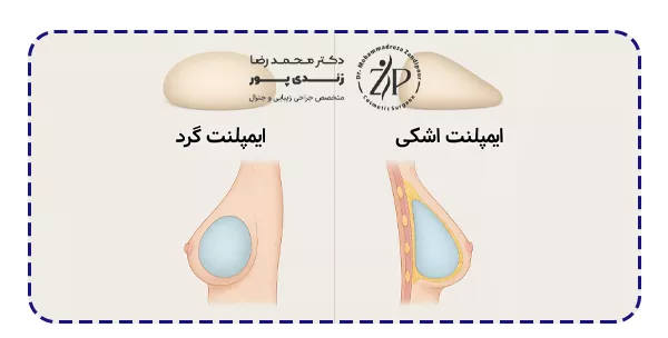 جراحی هر نوع پروتز چه تفاوتی دارد؟