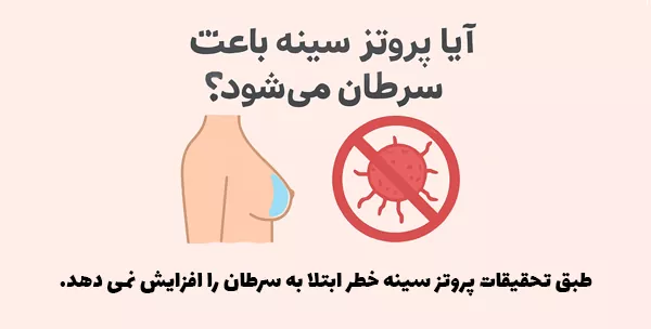 طبق تحقیقات پروتز سینه خطر ابتلا به سرطان را افزایش نمی دهد.