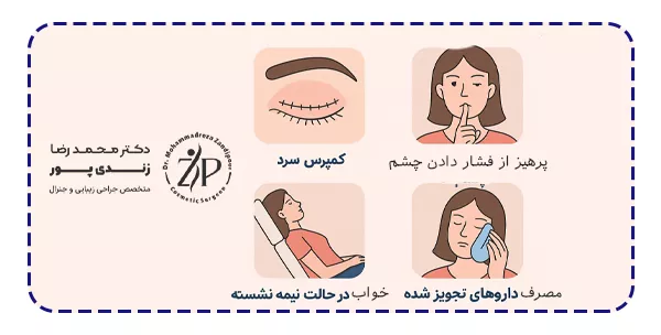مراقبت های بعد از بلفارو مراقبت های بعد از بلفارو
